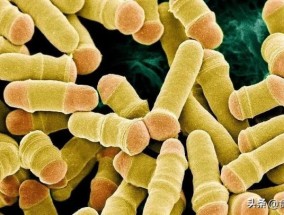 尿检类酵母菌高是什么原因 酵母菌超标是什么原因