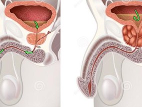前列腺在哪个部位图片 前列腺贴在哪个部位图片